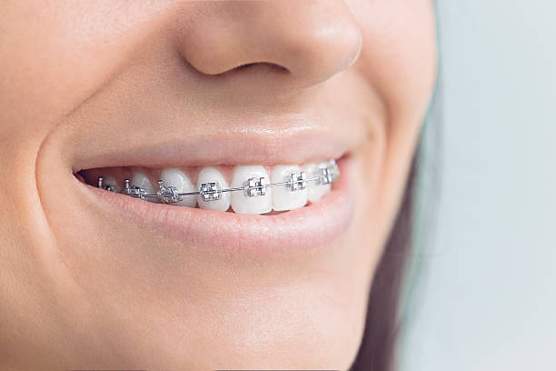 Laser Dentistry in Needles, CA